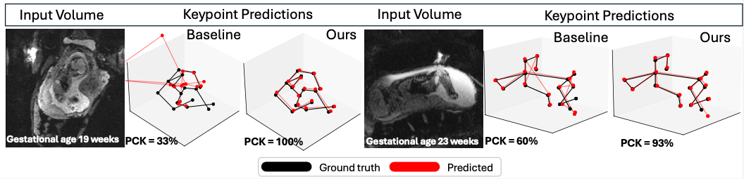 Figure from: Robust Fetal Pose Estimation across Gestational Ages via Cross-Population Augmentation